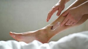 Zinkcreme – Wunden Heilen