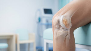 crossvit neocatril pro – knorpelschaden – wunden heilen